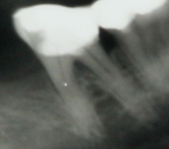 Several X-rays were performed and came back normal.