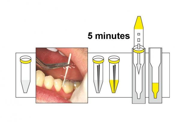 sulfur-toxin-measurement-5-minutes